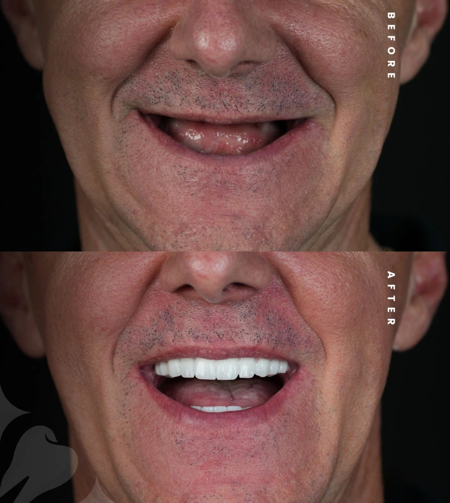 best dental clinic istanbul