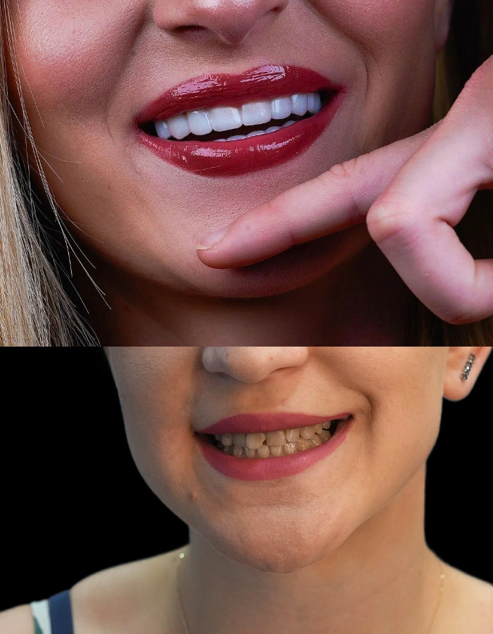 dental clinic istanbul