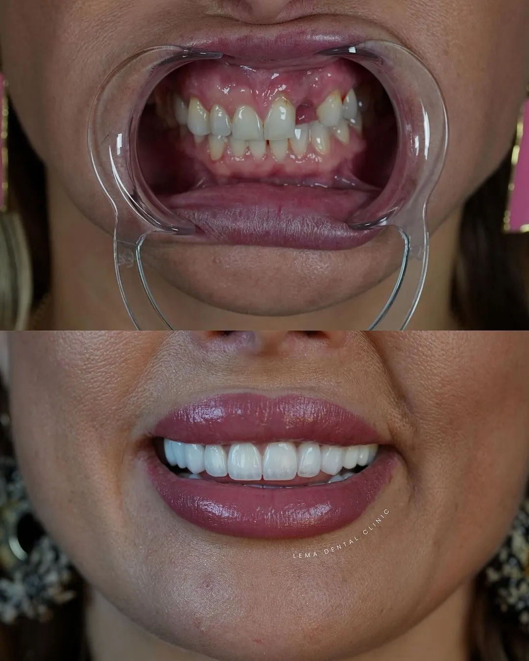 dental clinic istanbul