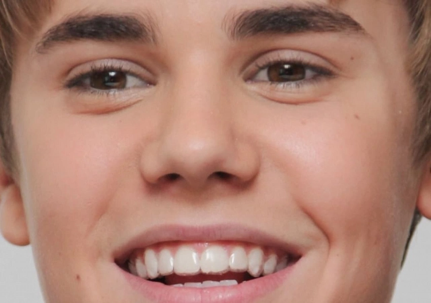 Justin Bieber new tooth