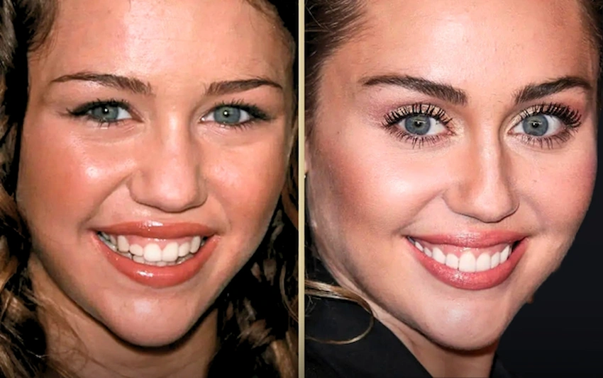 Miley Cyrus teeth