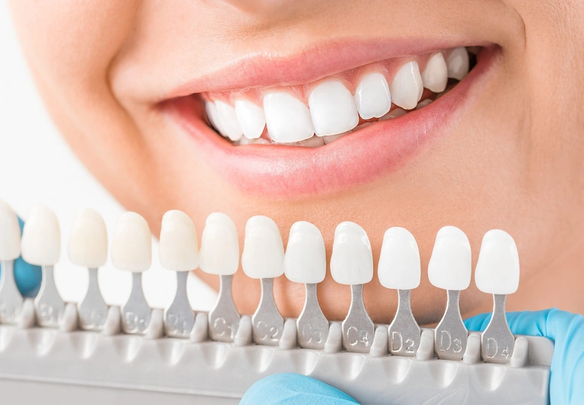 benefits of dental crowns
