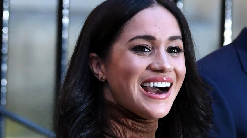 meghan markle after teeth