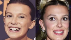 millie bobby brown before after