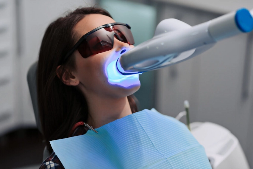 blanqueamiento dental