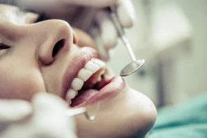 composite bonding