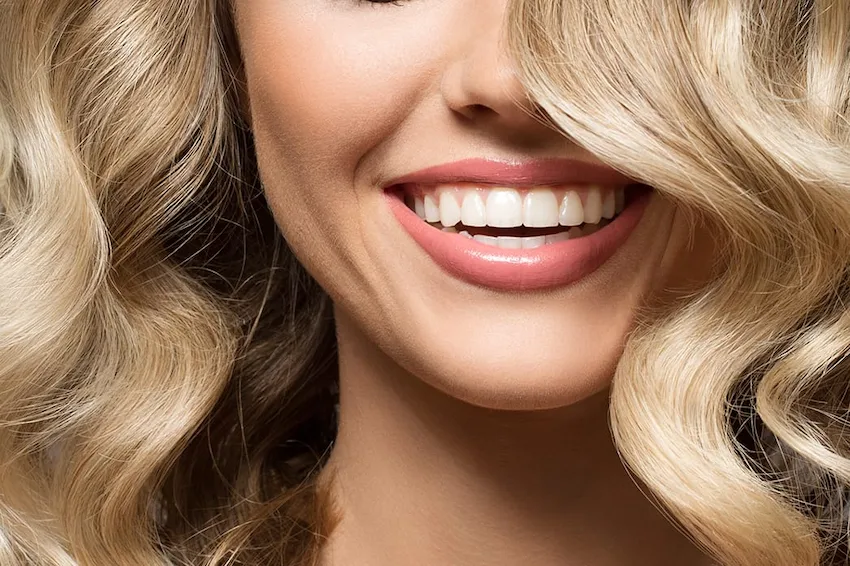 porcelain veneers price and advantages