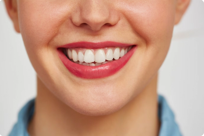 teeth whitening method