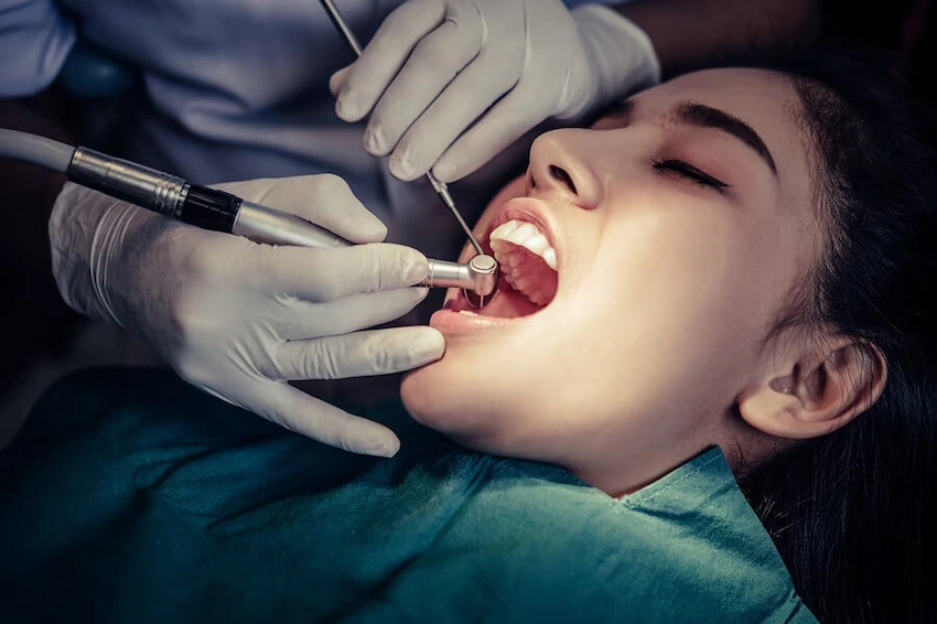 extragere dentară