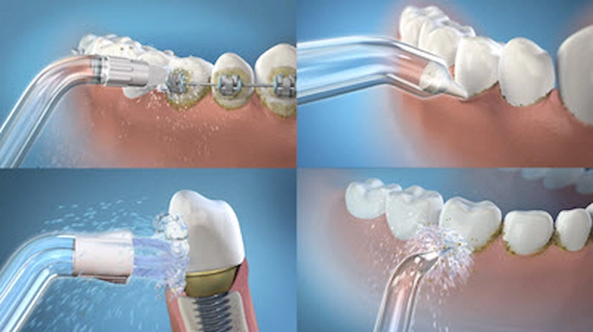water flosser tips