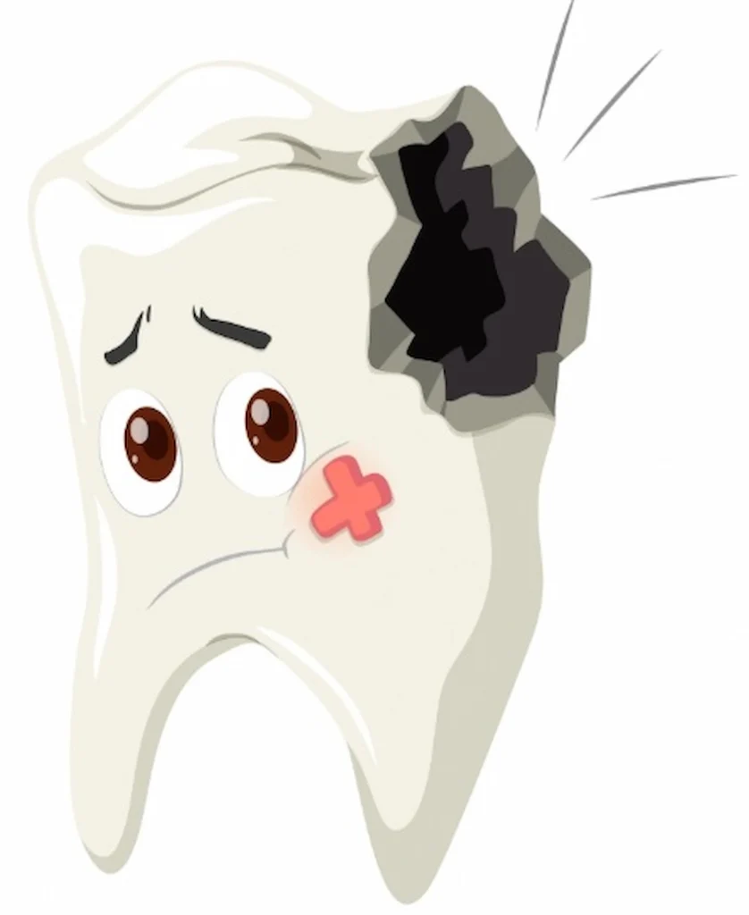 caries dental
