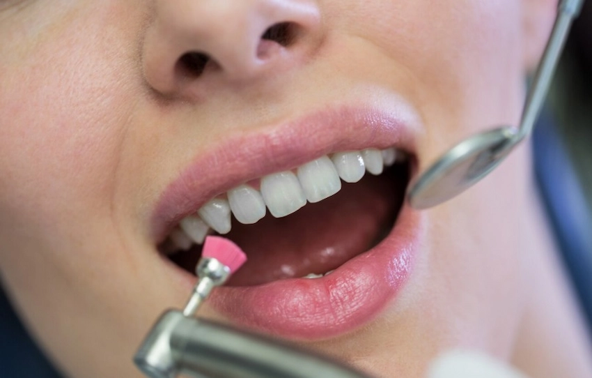 teeth enamel treatment