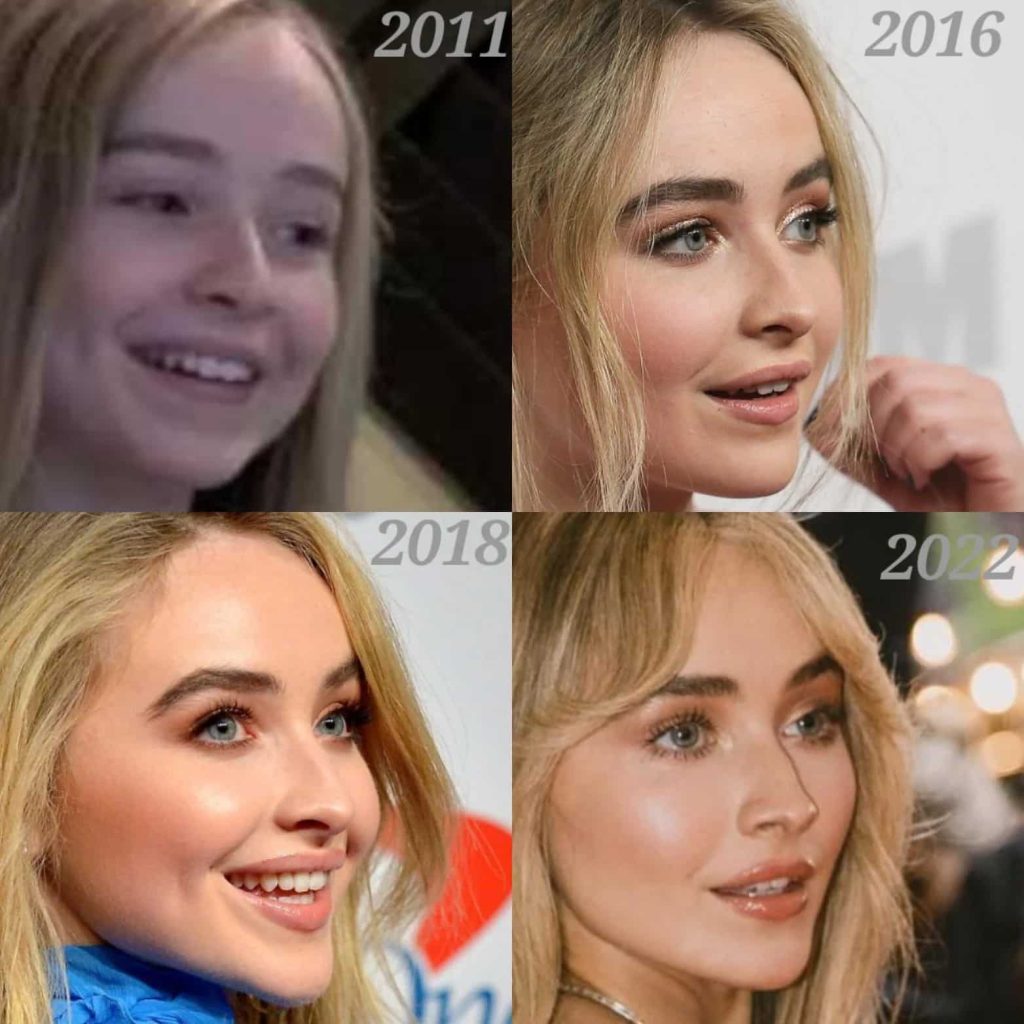 Sabrina-Carpenter-Nuevo-Dientes-Nuevo-Dental-2