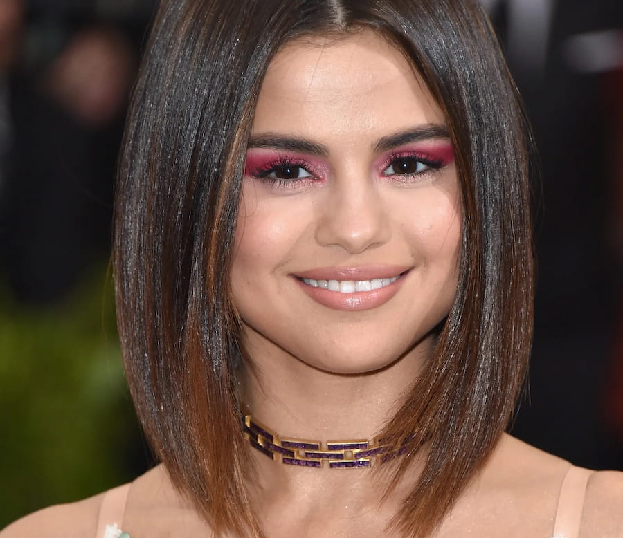 selena gomez new teeth new dental 2017