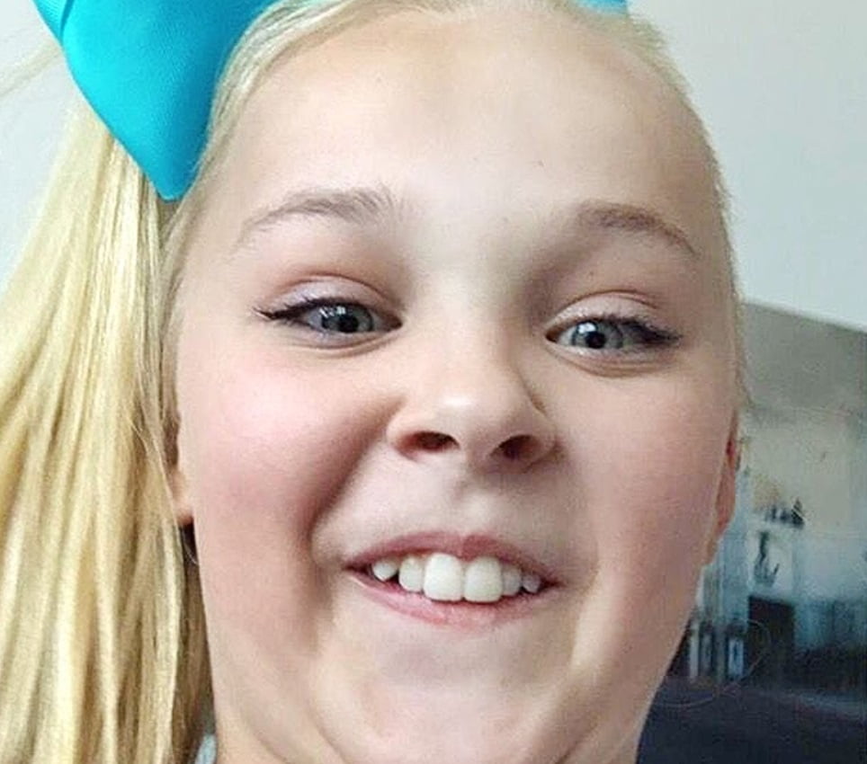 jojo siwa teeth in 2015