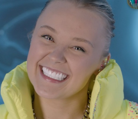 jojo siwa teeth in 2025 after procedure
