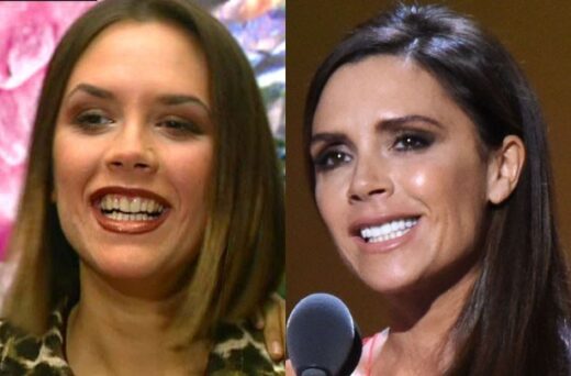 victoria beckham zähne vorher und nachher