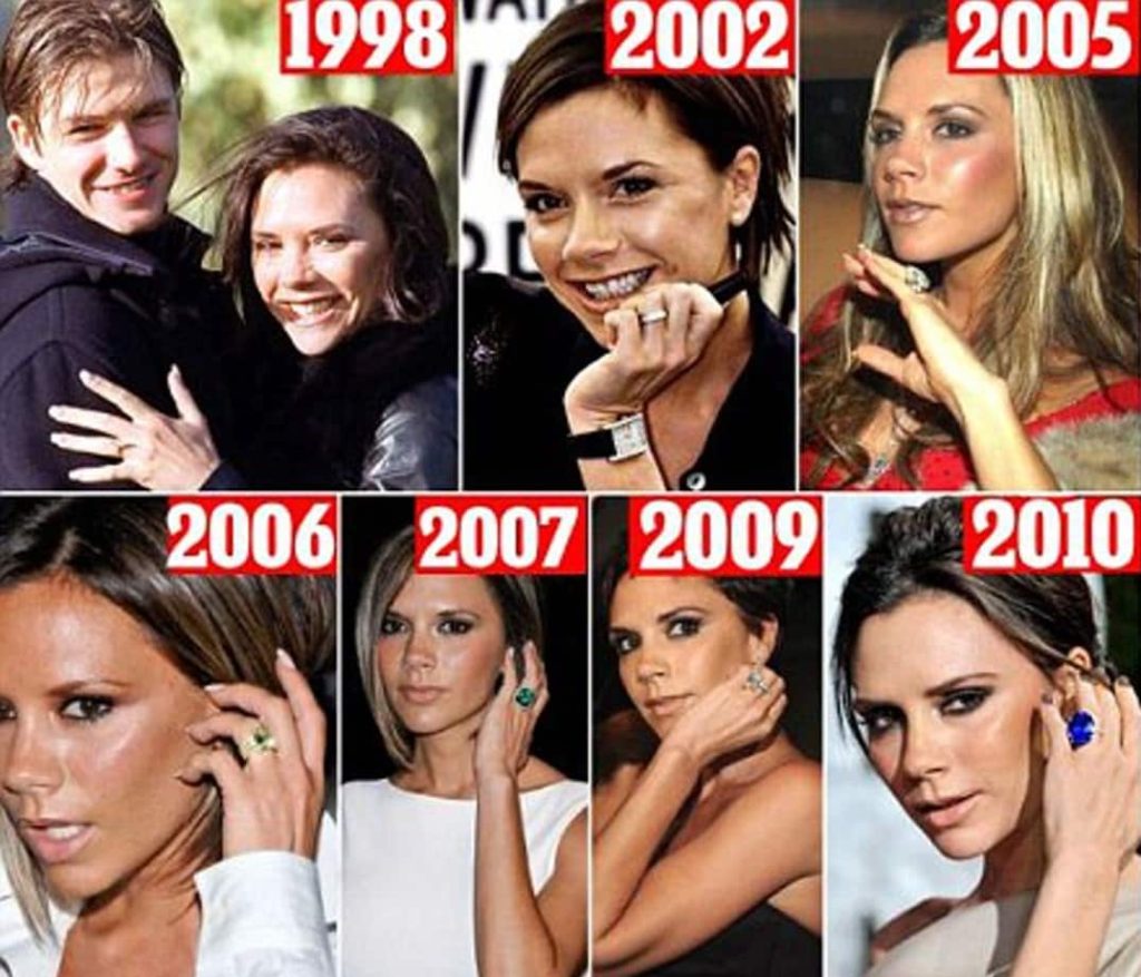 victoria beckham zähne im jahr 2005