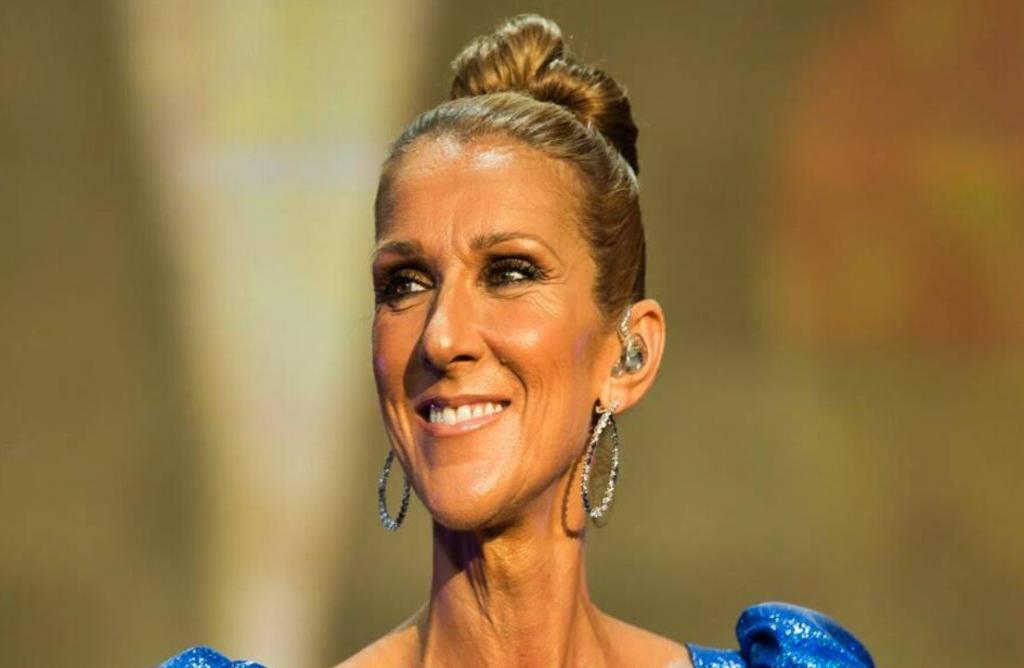 dientes de celine dion en 2025