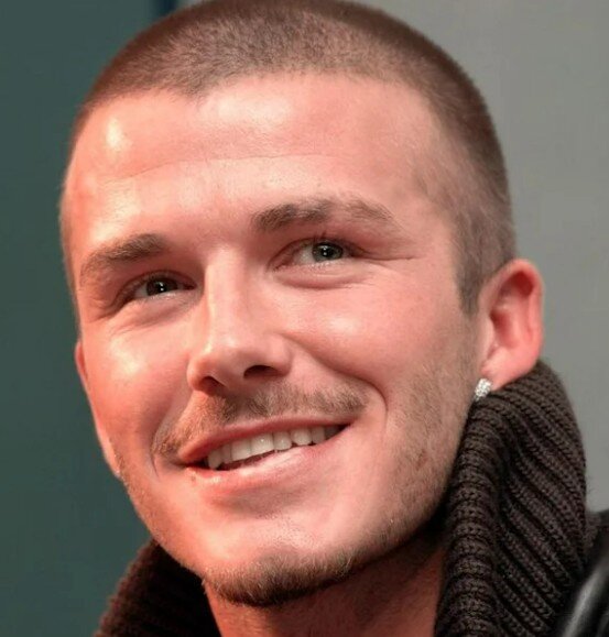 david beckham teeth in 2001