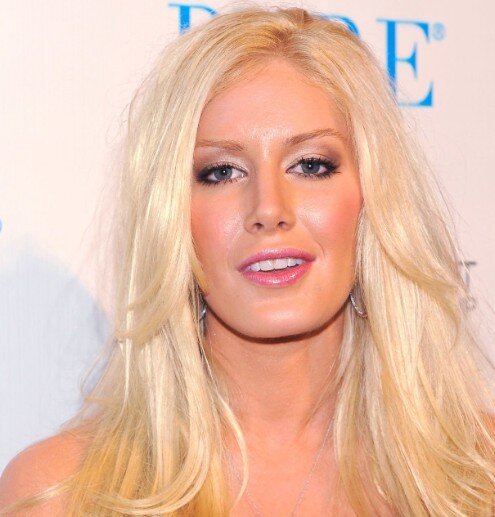 les dents de Heidi Montag en 2010