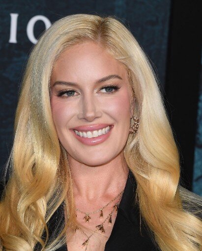 les dents de Heidi Montag en 2025