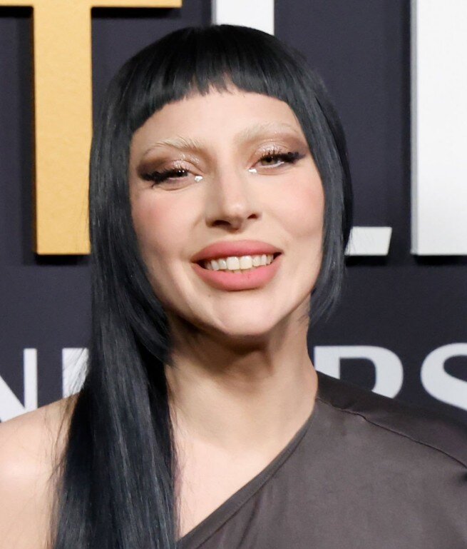 lady gaga teeth in 2025