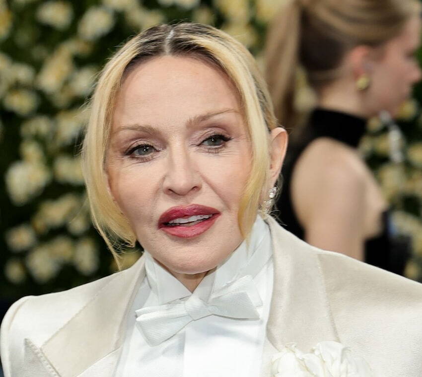dientes de madonna en 2000