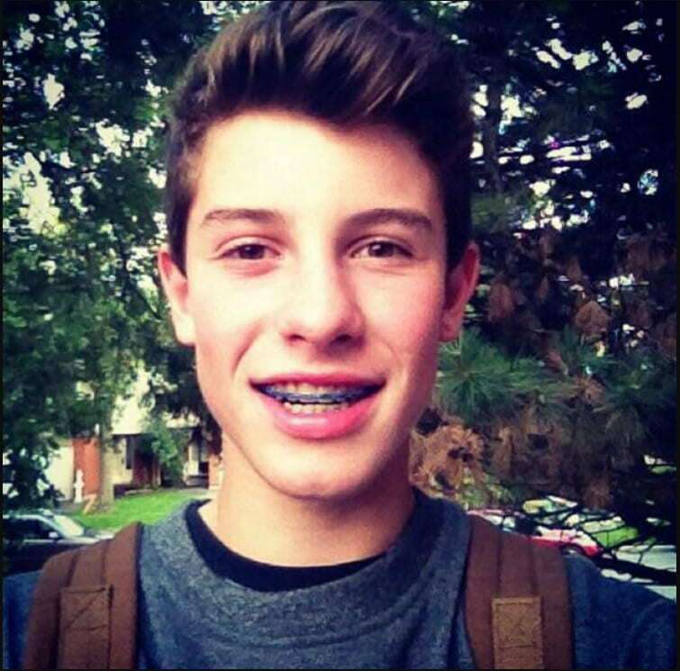 i denti di shawn mendes nel 2011
