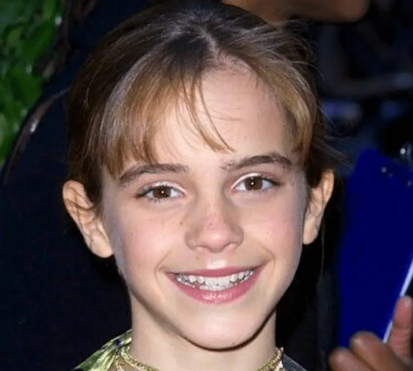 emma watson teeth 2000