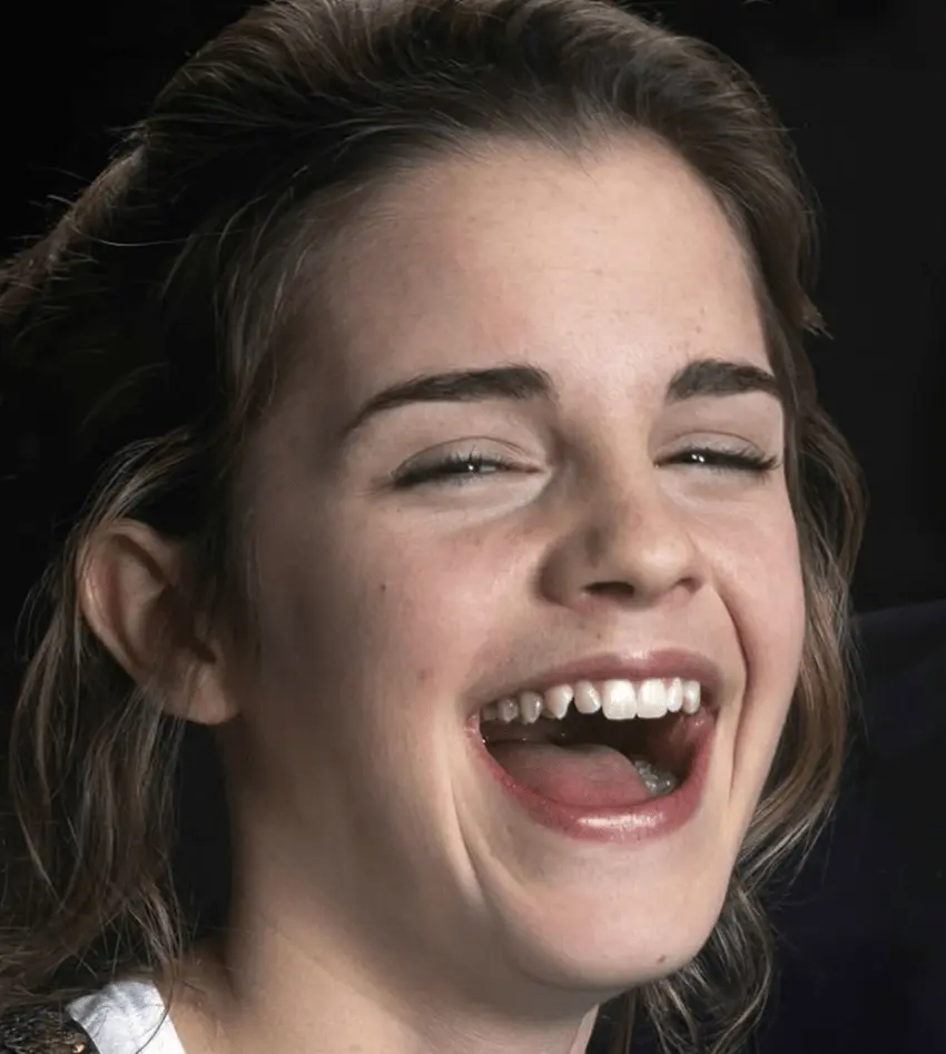 emma watson teeth 2010