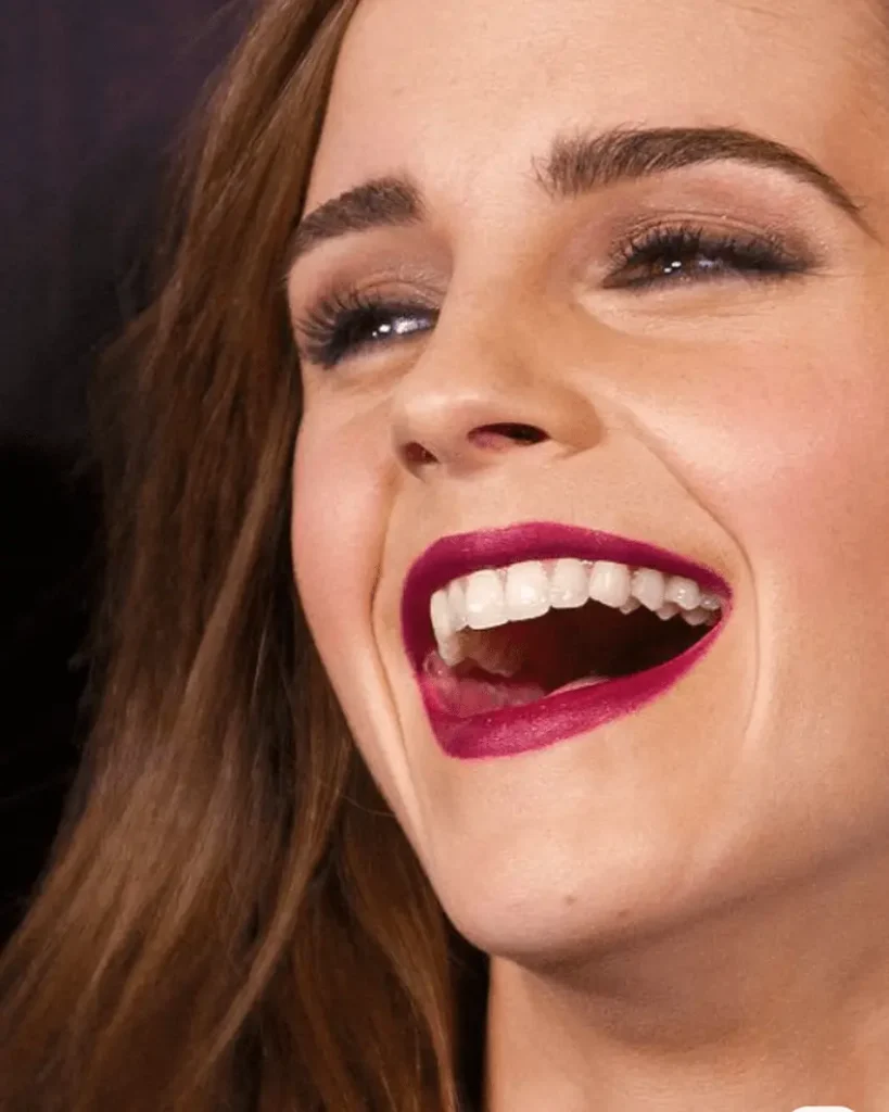 emma watson teeth transformation now