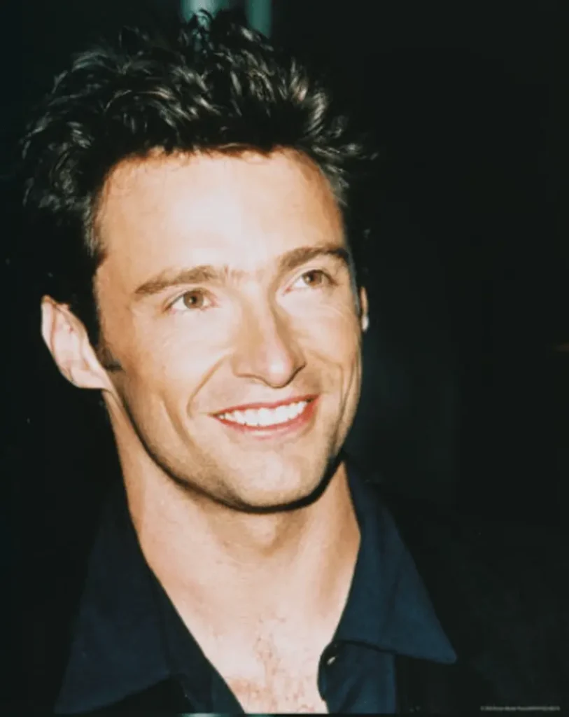 hugh jackman teeth 2010s
