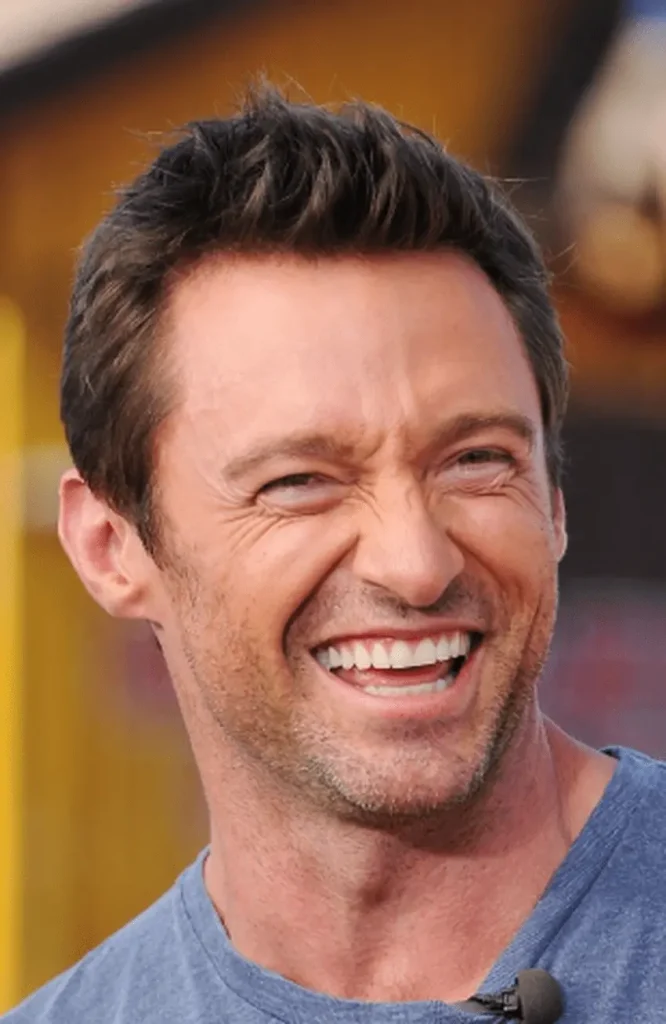 hugh jacman teeth in 2015