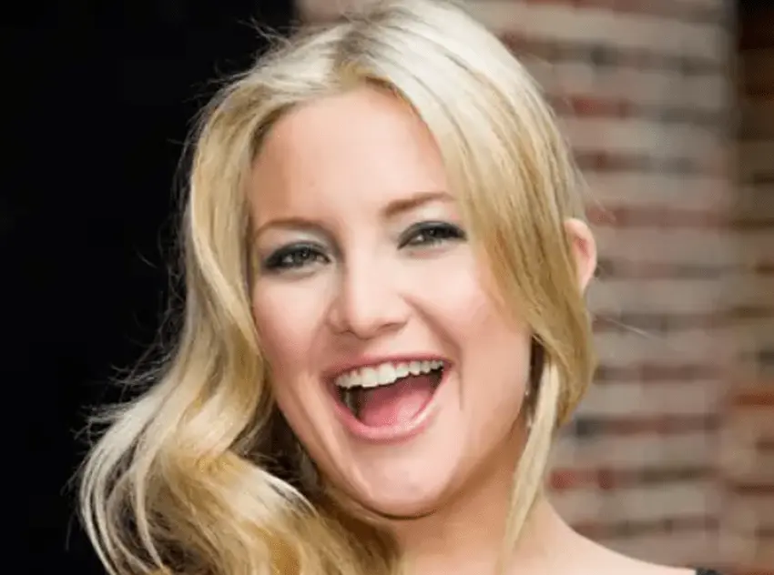kate hudson teeth 2010s