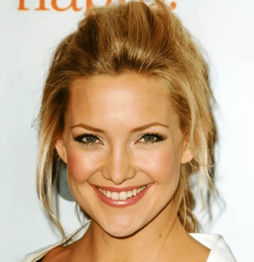 kate hudson teeth 2015s