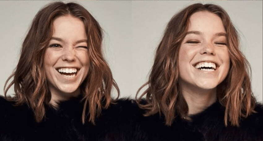 milly alcock before after