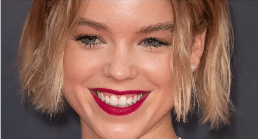 milly alcock teeth in 2020