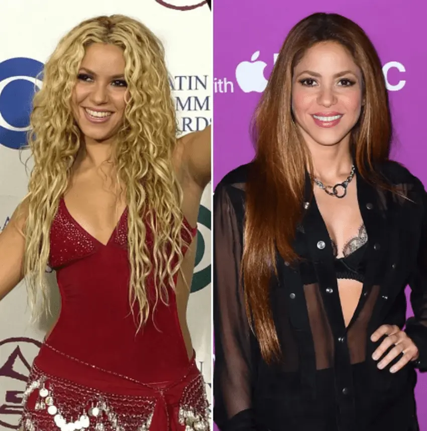 shakira teeth transformation