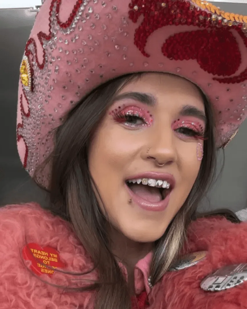 sierra ferrel teeth transformaiton over years (1)