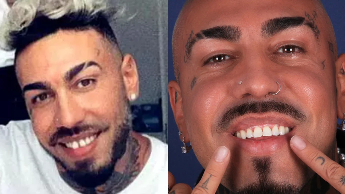 alex velea before after