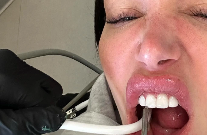 anastasia karanikolaou teeth