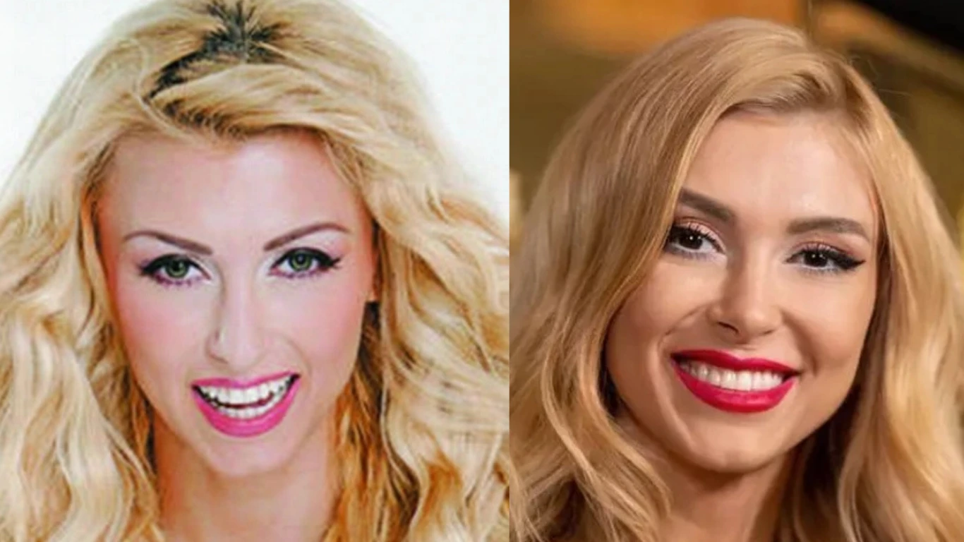 andreea bălan before after