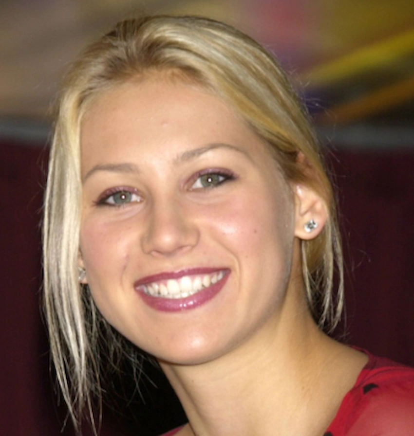 anna kournikova teeth 2000