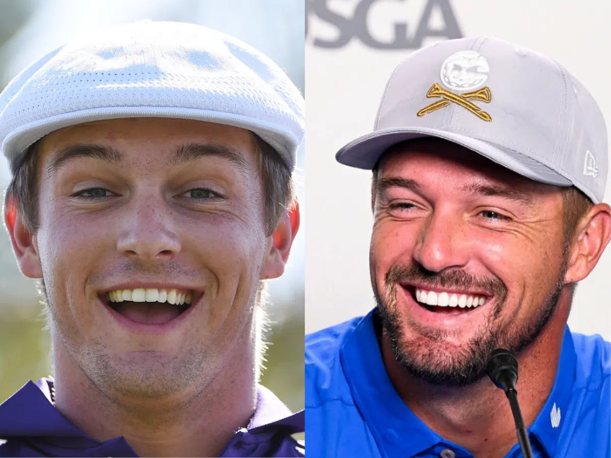 bryson dechambeau teeth before after
