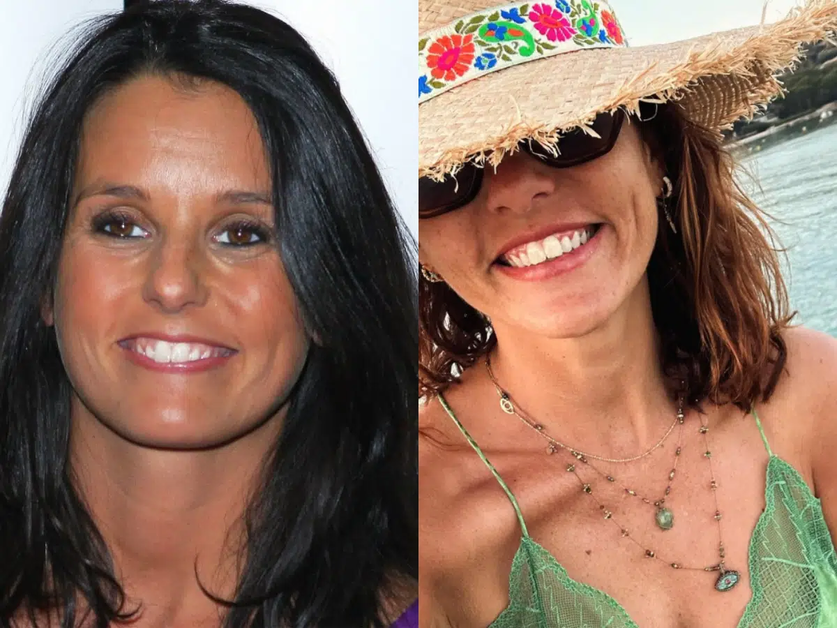 faustine bollaert teeth before after