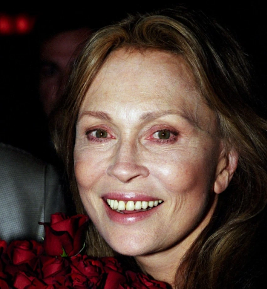 faye dunaway teeth 2000