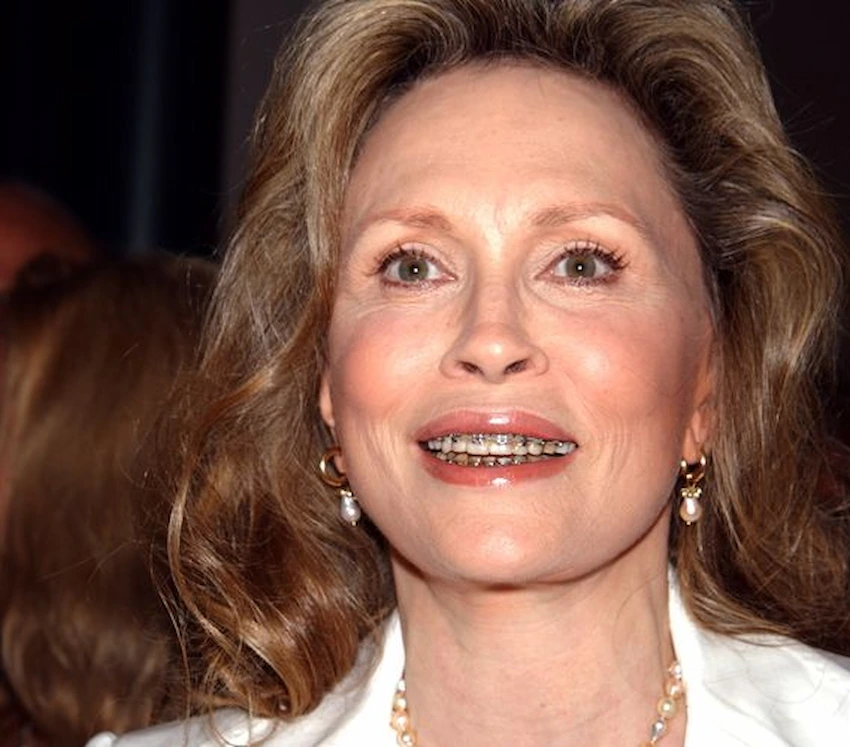 faye dunaway teeth 2002