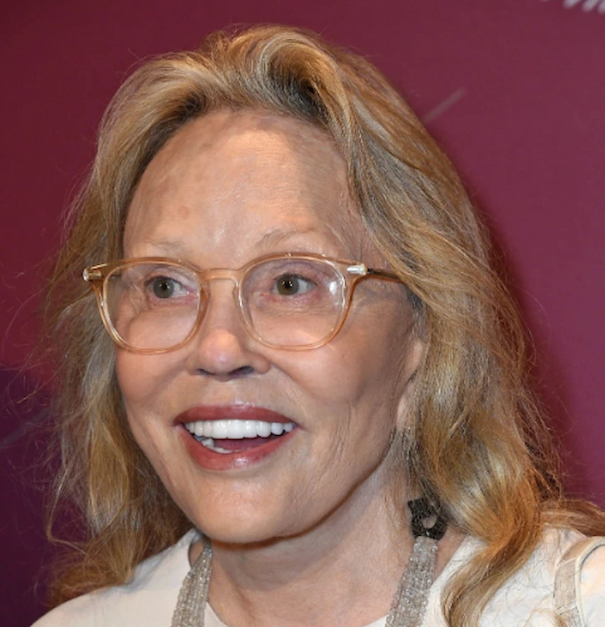 faye dunaway teeth 2020
