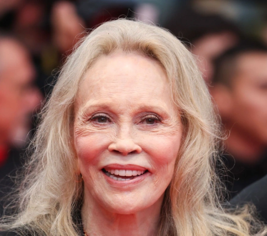 faye dunaway teeth 2025